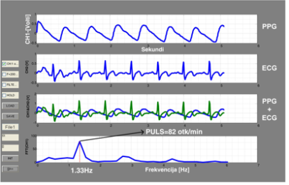 Virtuelni instrument za mjerenje i prikaz ECG i PPG signala